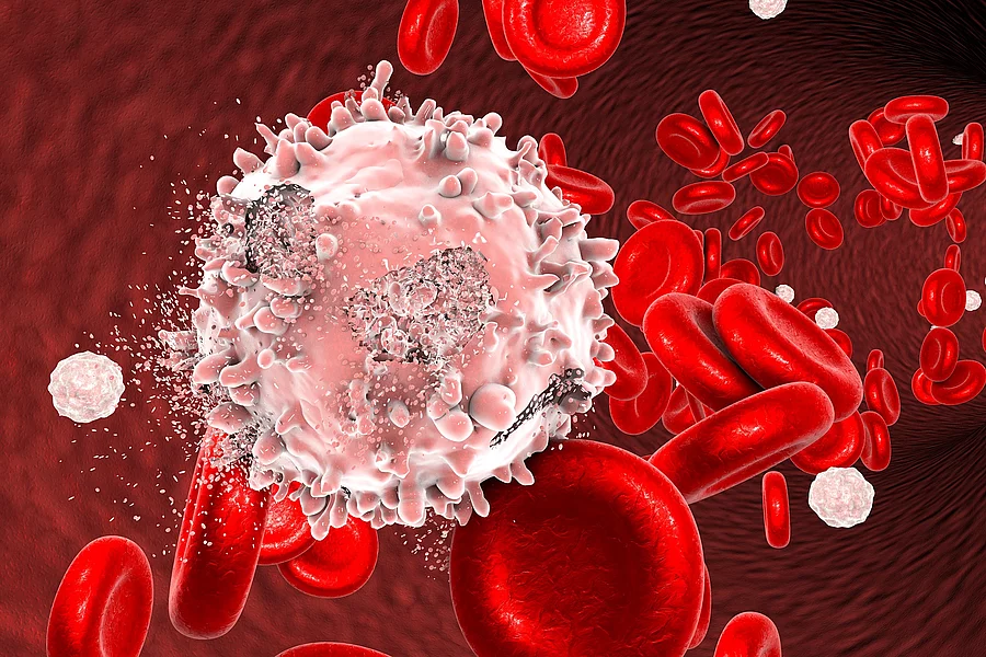 Destruction of leukaemia cell Illustration: Blutzellen und zerstörte Leukämiezelle