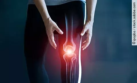 Frau hält sich das Knie, Kniegelenk ist rot illustriert als Symbol für Knieschmerz