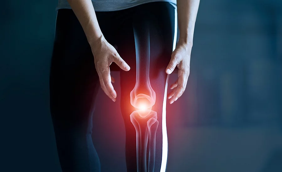 Frau hält sich das Knie, Kniegelenk ist rot illustriert als Symbol für Knieschmerz
