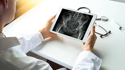 Arzt schaut sich Röntgenbild einer Hüfte auf Tablet an
