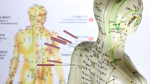 Weibliches Akupunkturmodell mit Nadeln im Schulterbereich vor Lehrtafel