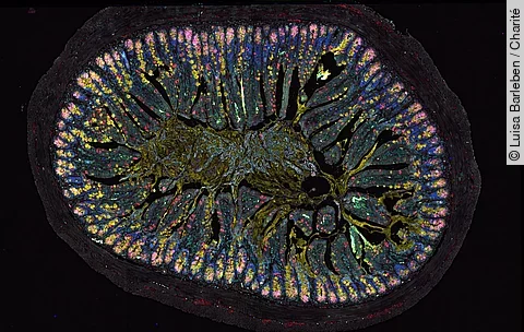 Gewebeschnitt der Darmoberfläche (Mausmodell) mit verschiedenfarbig gefärbten Zelltypen 