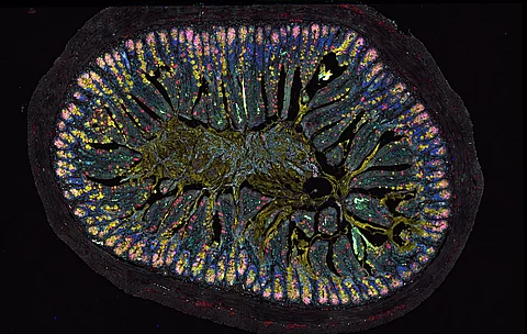 Gewebeschnitt der Darmoberfläche (Mausmodell) mit verschiedenfarbig gefärbten Zelltypen 