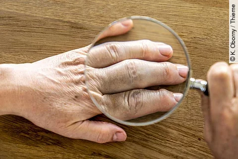 Hand die mit einer Lupe untersucht wird.