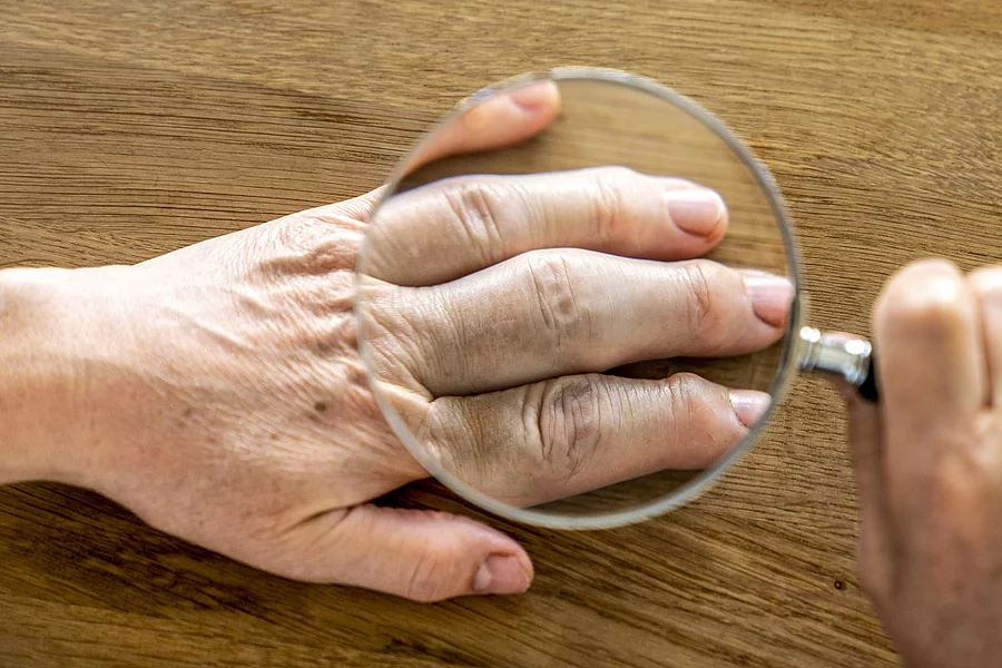 Hand die mit einer Lupe untersucht wird.