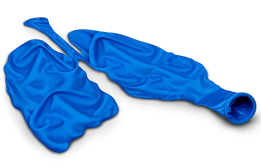 Symbolbild COPD: 2 leere Luftballons in Lungenform gelegt