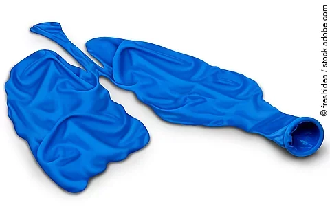 Symbolbild COPD: 2 leere Luftballons in Lungenform gelegt