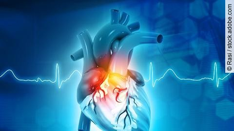 Anatomie Herz, EKG-Kurve im Hintergrund
