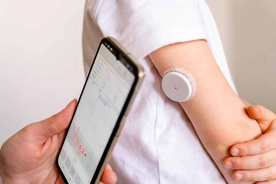 Blutzuckermesssystem am Oberarm einer Person, daneben ein Smartphone mit den Ergebnissen Blutzuckermesssystem am Oberarm einer Person, daneben ein Smartphone mit den Ergebnissen