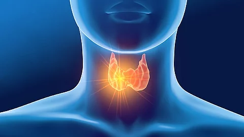 Schilddrüse, Thyreoiditis, Hashimoto, Frau