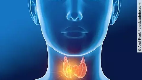 Thyroid gland of a woman, medically 3D illustration on blue back Schilddrüse, Thyreoiditis, Hashimoto, Frau