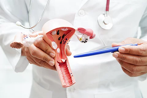 Ein Arzt hält ein anatomisches Modell von Gebärmutter, Eierstöcken und Vagina in der Hand und deutet mit einem Stift auf den Gebärmutterhals. 