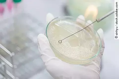 Forscher*in nimmt Abstrich von einer Petrischale 