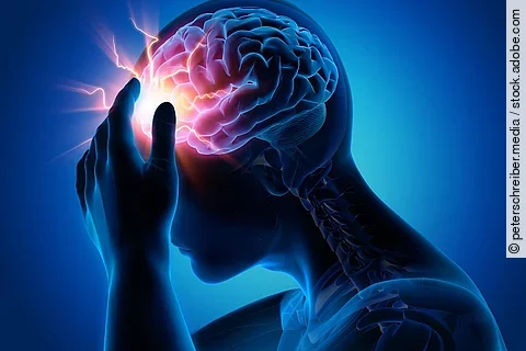 Schlaganfall, Apoplex, Insult, stroke