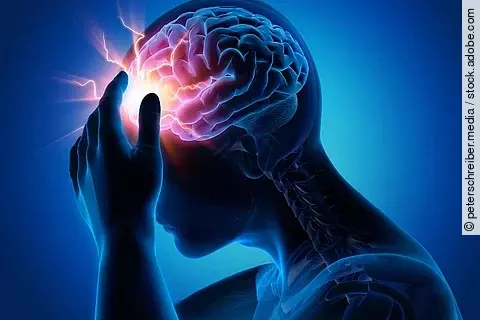 Schlaganfall, Apoplex, Insult, stroke