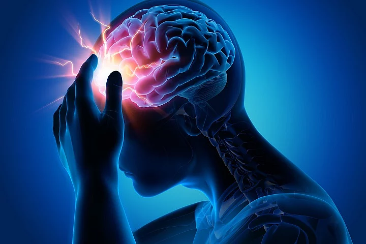 Schlaganfall, Apoplex, Insult, stroke