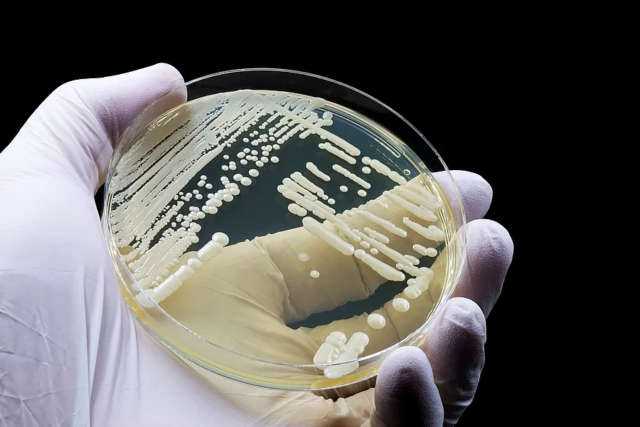 Hand mit Gummihandschuh hält Petrischale mit gezüchtetem Candida auris