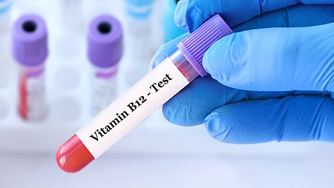 Hand mit Laborhandschuh hält eine Monovette mit Blut und der Aufschrift Vitamin B12