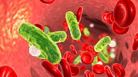 Sepsis, Bakterien im Blut