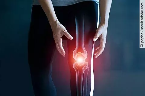 Knie, Knieschmerz, Rheuma, Entzündung