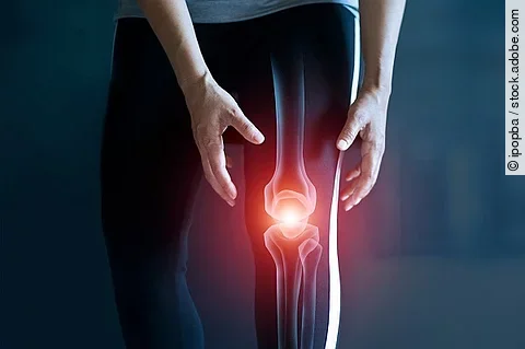 Knie, Knieschmerz, Rheuma, Entzündung