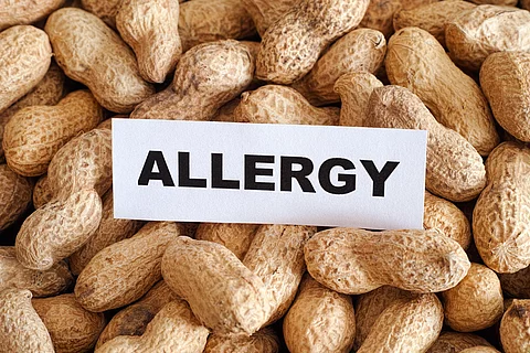 In Mitten von Erdnüssen liegt ein Zettel mit der Aufschrift "Allergy"