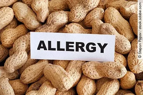 In Mitten von Erdnüssen liegt ein Zettel mit der Aufschrift "Allergy"