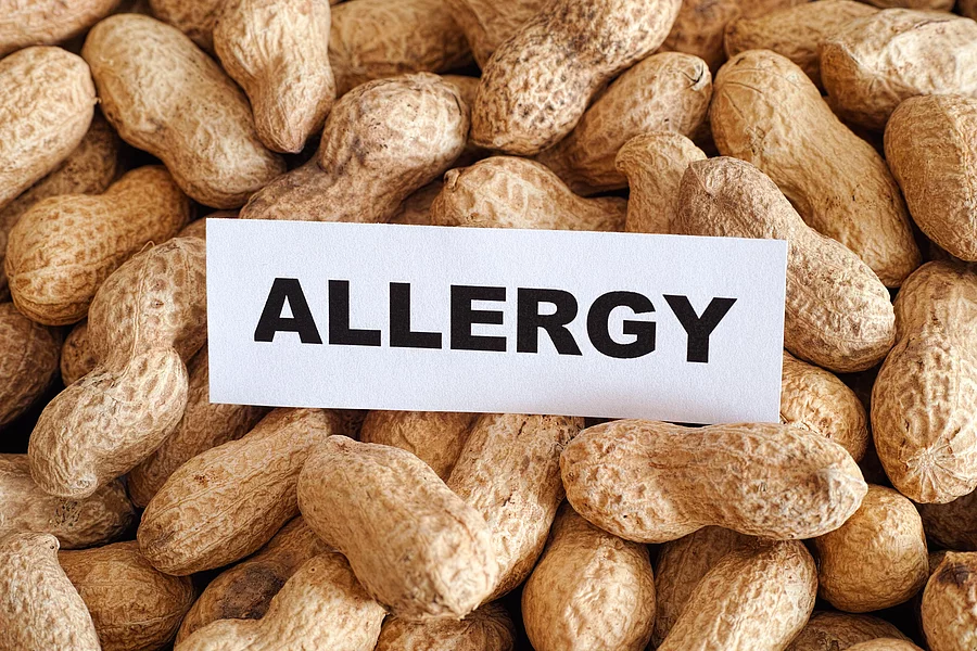 In Mitten von Erdnüssen liegt ein Zettel mit der Aufschrift "Allergy"