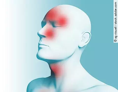 Schmerz, Kopfschmerz