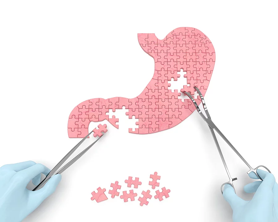 Magen Puzzle mit herausgenommenen Stücken