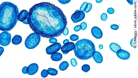 Illustration: MPox-Viren blau eingefärbt auf weißem Hintergrund
