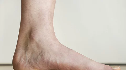 Innenfuß von der Seite