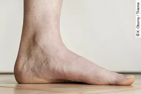 Innenfuß von der Seite