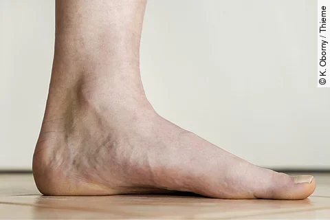 Innenfuß von der Seite