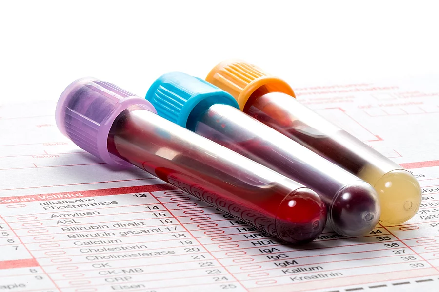 Blutuntersuchung, Blutproben auf einem Laborformular Blutröhrchen mit Blutproben auf einem Laborformular