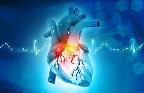Modell eines Herzens mit farblich gekennzeichnetem problematischem Bereich, im Hintergrund eine EKG-Kurve