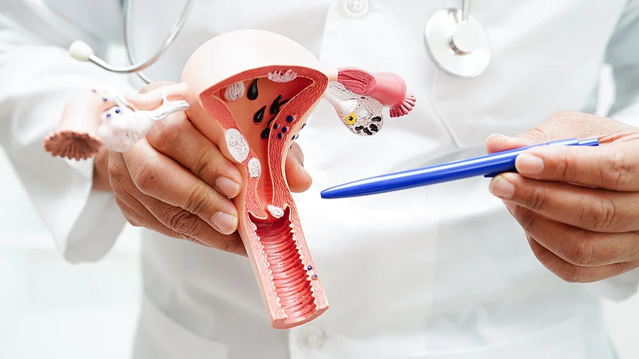 Arzt hält Model eines Uterus in den Händen und deutet mit einem Stift darauf
