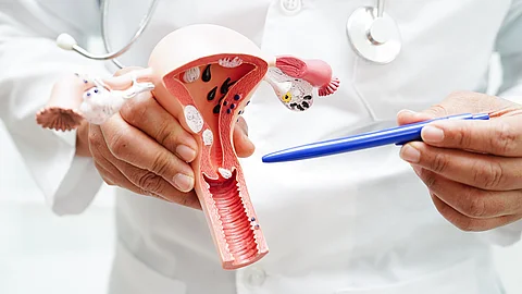 Arzt hält Model eines Uterus in den Händen und deutet mit einem Stift darauf