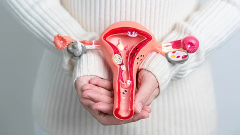 Frau hält ein Modell aus Uterus und Eierstöcken mit Endometriose vor ihrem Unterbauch