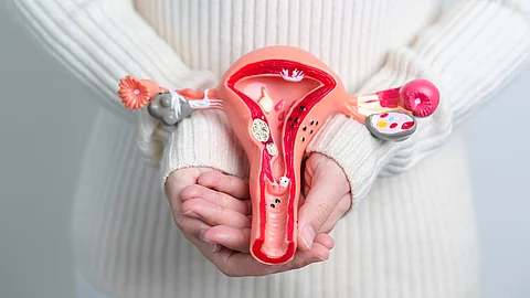 Frau hält ein Modell aus Uterus und Eierstöcken mit Endometriose vor ihrem Unterbauch