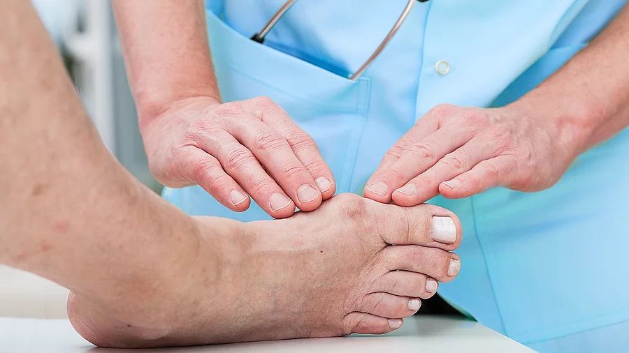 Arzthände untersuchen einen Fuß mit Hallux valgus Arzthände untersuchen einen Fuß mit Hallux valgus