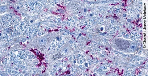 Ausschnitt aus dem Hirnstamm: Nervenzellen (graublau) stehen eng mit hirneigenen Immunzellen (lila)