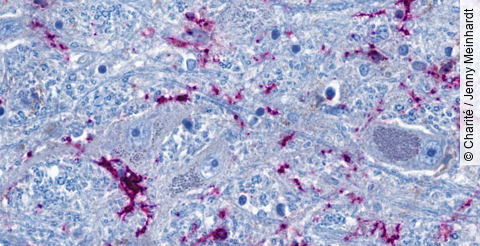 Ausschnitt aus dem Hirnstamm: Nervenzellen (graublau) stehen eng mit hirneigenen Immunzellen (lila)