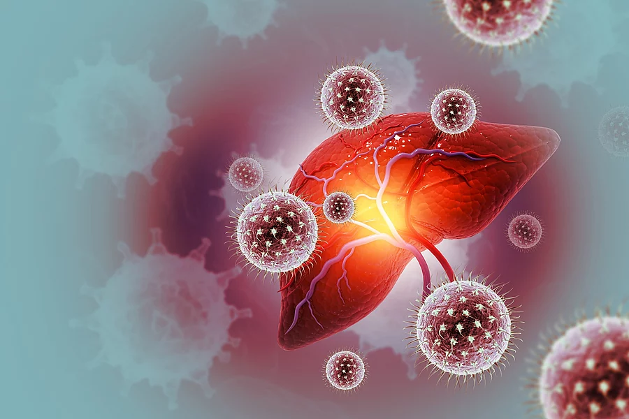 Illustration: entzündete Leber mit Hepatitisviren Illustration: entzündete Leber mit Hepatitisviren