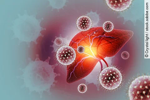 Illustration: entzündete Leber mit Hepatitisviren