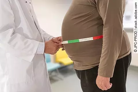 Arzt misst Bauchumfang eines übergewichtigen Mannes.