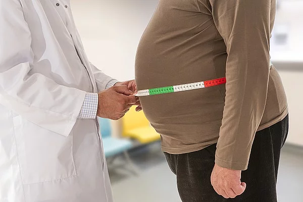 Arzt misst Bauchumfang bei adipösem Patienten.