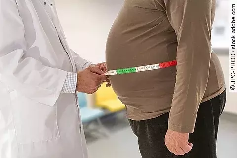 Arzt misst Bauchumfang bei adipösem Patienten.