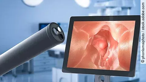 Monitor mit Darminnerem auf dem Screen