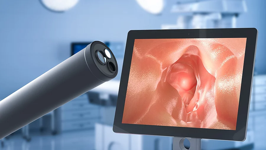 Monitor mit Darminnerem auf dem Screen